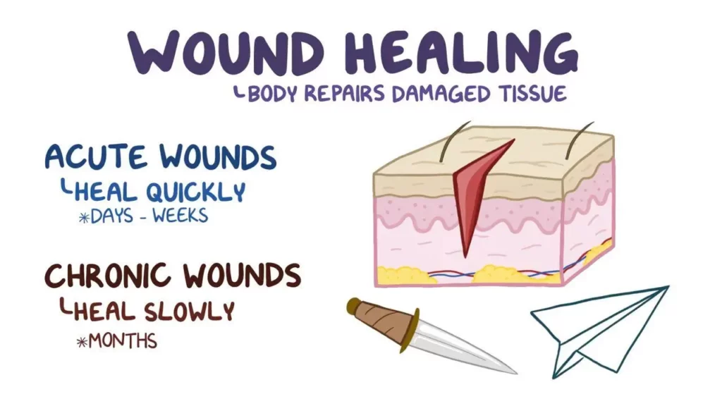 how do wounds heal with calories