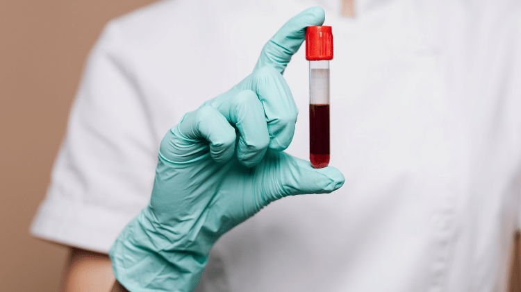 why getting bloodwork is important when using ped
